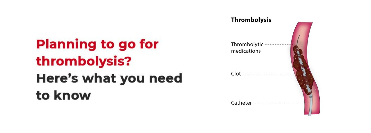 Planning to go for Thrombolysis? Here what you need to know